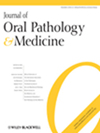 J ORAL PATHOL MED期刊全称