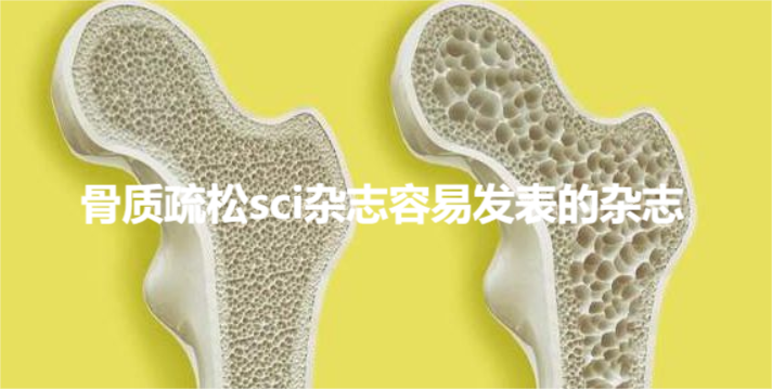 骨质疏松sci方面容易发表的杂志