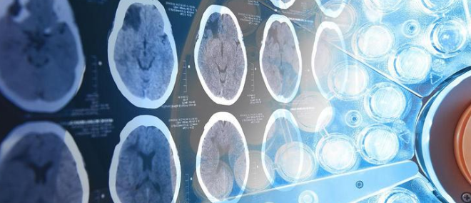 影像学SCI推荐,老牌经典、毕业神刊全都有