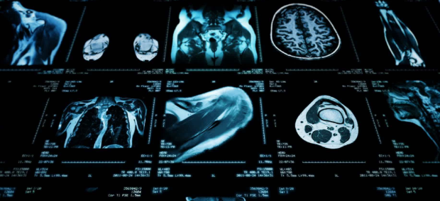 影像学类SCI老牌经典、毕业神刊推荐