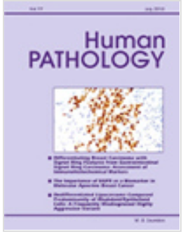  HUMAN PATHOLOGY期刊