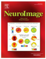 NEUROIMAGE期刊