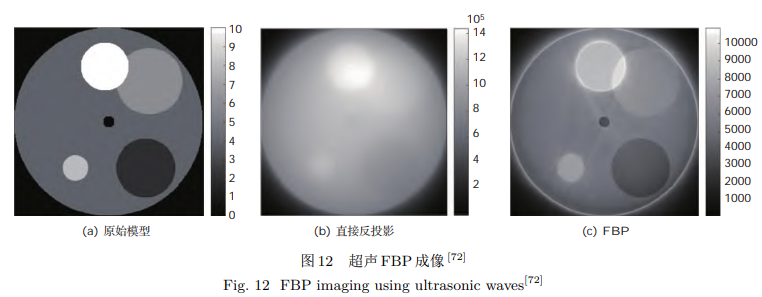 超声 FBP 成像