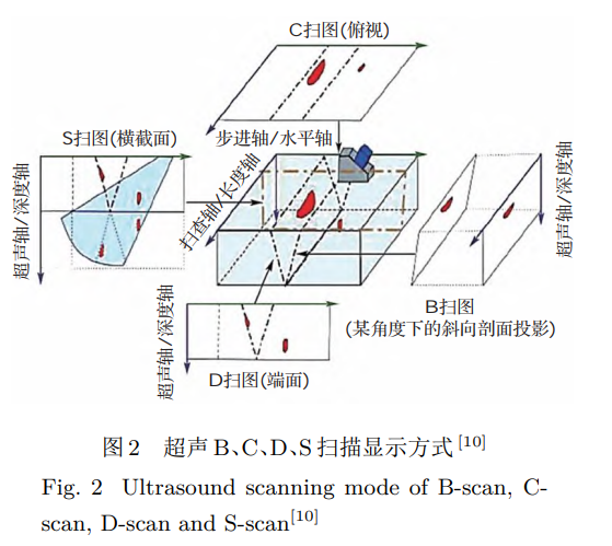 超声 B、C、D、S 扫描显示方式